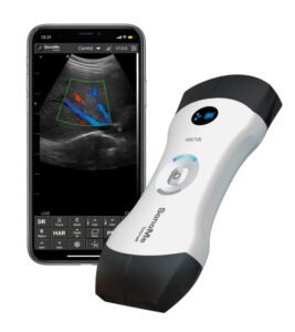 Handheld Ultrasound Bionet SonoMe