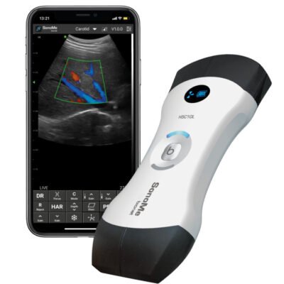 Handheld Ultrasound Bionet SonoMe