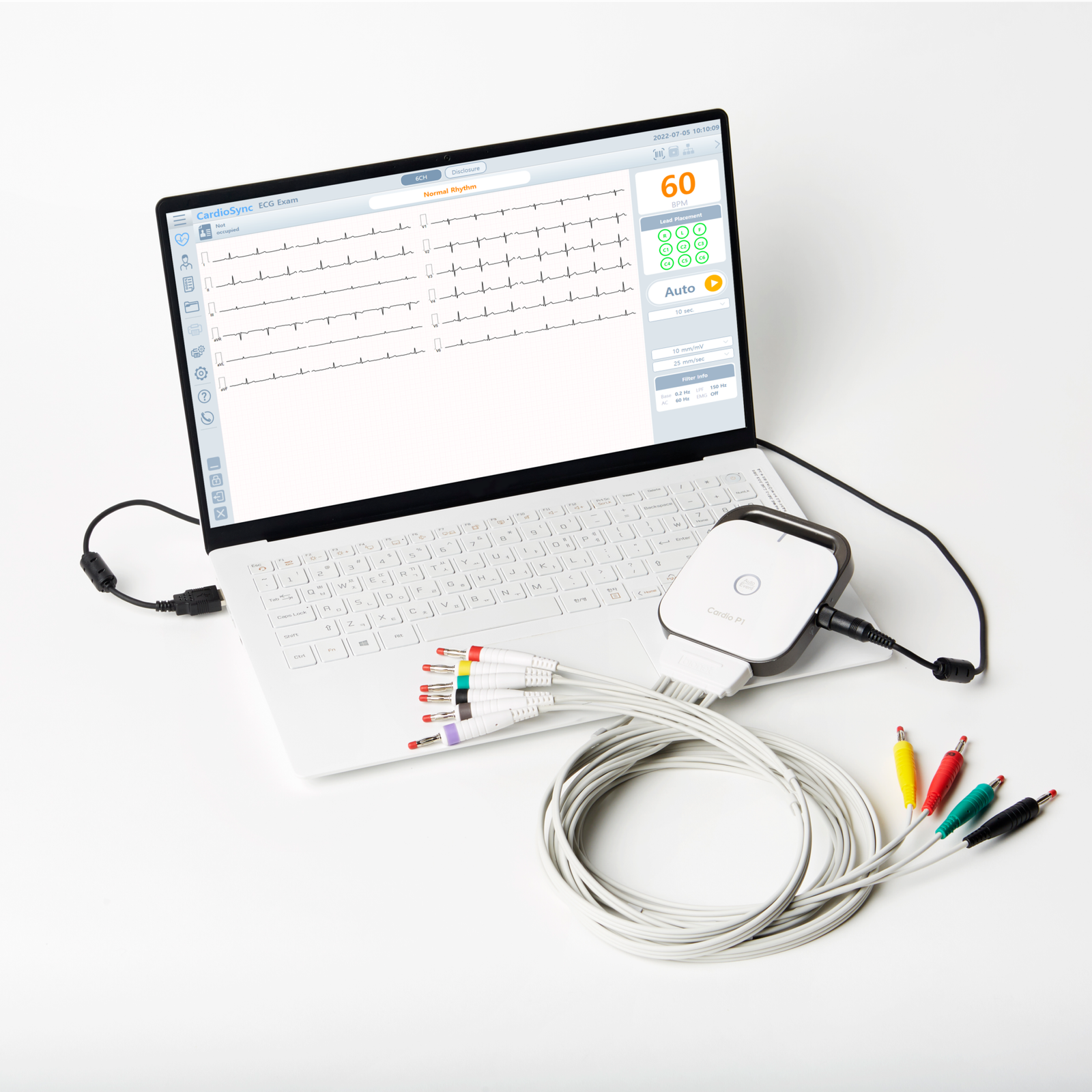 Cardionet Module Cardio P1 - Bionet Europe GmbH